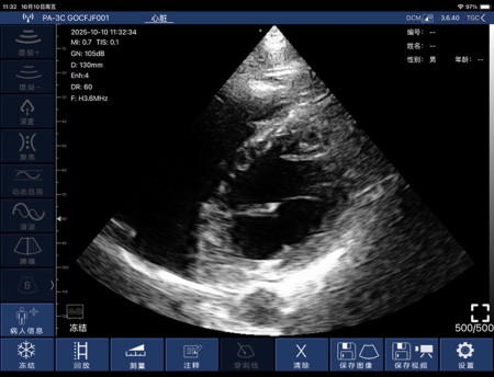 Echo serca scan palm usg