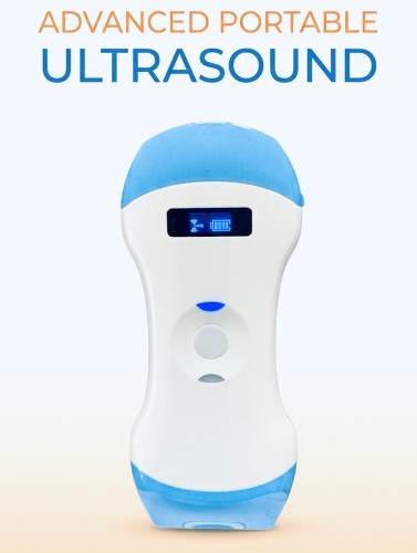 Przejdź do produktu Ultrasonograf  WiFi  inPOCUS 5CPL