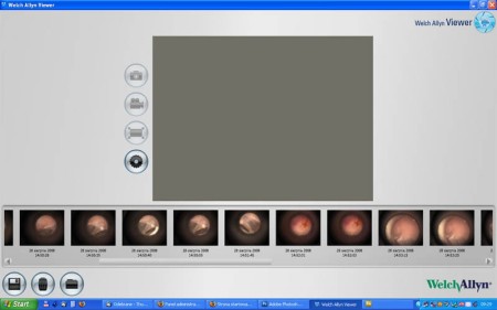zdjecia badania otoskopowego cyfrowa otoskopia
