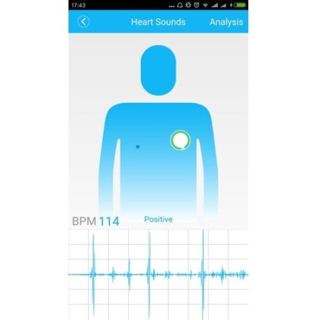 Stetoskop Elektroniczny