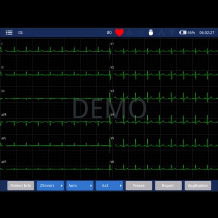 Aparat EKG Zoncare iMAC 120