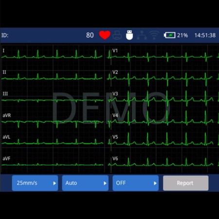 Aparat EKG Zoncare iMAC 300
