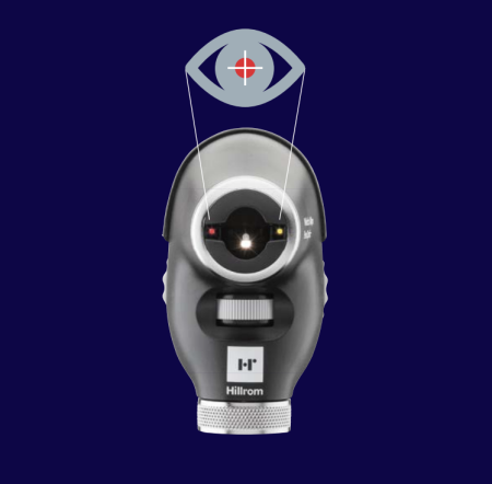 System zbieżności QuickEye™ ułatwia skierowanie wzroku pacjenta tak, aby wyrównać tarczę nerwu wzrokowego