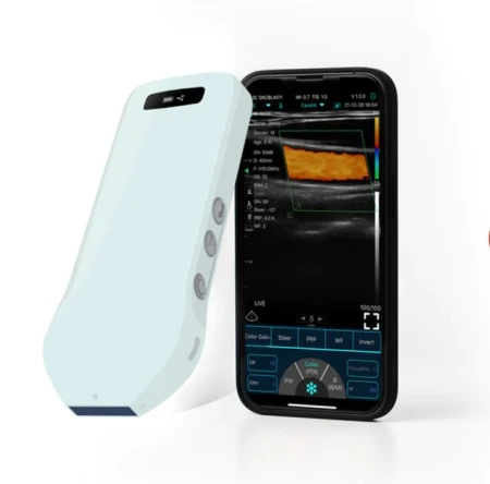 USG z aplikacją na telefon