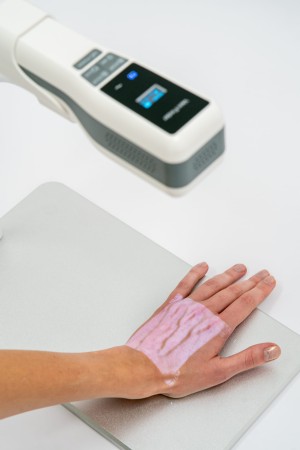 skaner uwidaczniający żyły medica 91