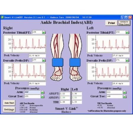 Oprogramowanie V-Link Doppler Hadeco