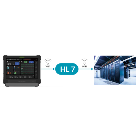 System Wczesnego Ostrzegania (EWS) w monitorze AIView VS, wyświetlający wartość punktową i radarogram, które natychmiast informują personel medyczny o potencjalnym pogorszeniu stanu pacjenta.