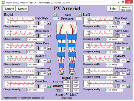 PV Arterial