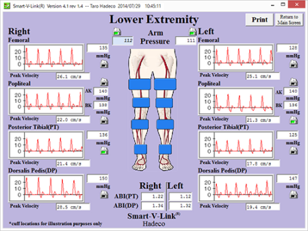 Lower Extremity Segmental