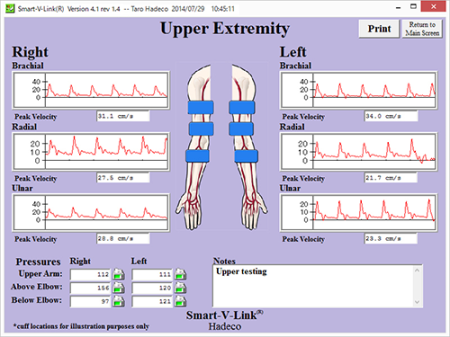 Upper Extremity Segmental