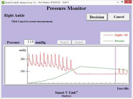 Pressure Monitor
