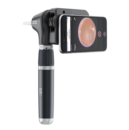 nowoczesny otoskop macroview