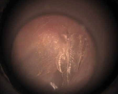 zdjecie fotografia badania cyfrowa welch allyn  sklep online dla lekarzy sprzęt medyczny