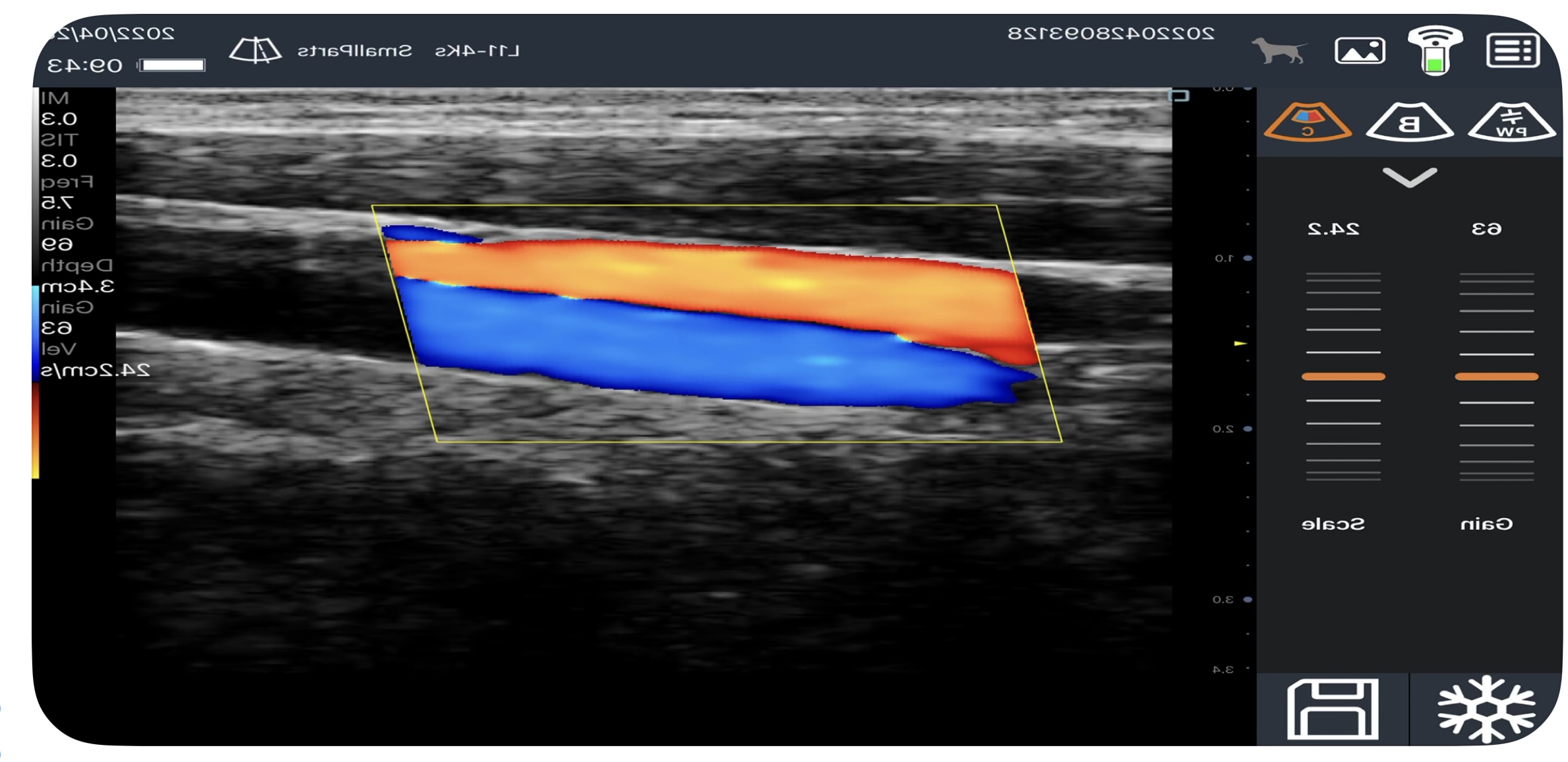 POCUS Scan kolor doppler 
