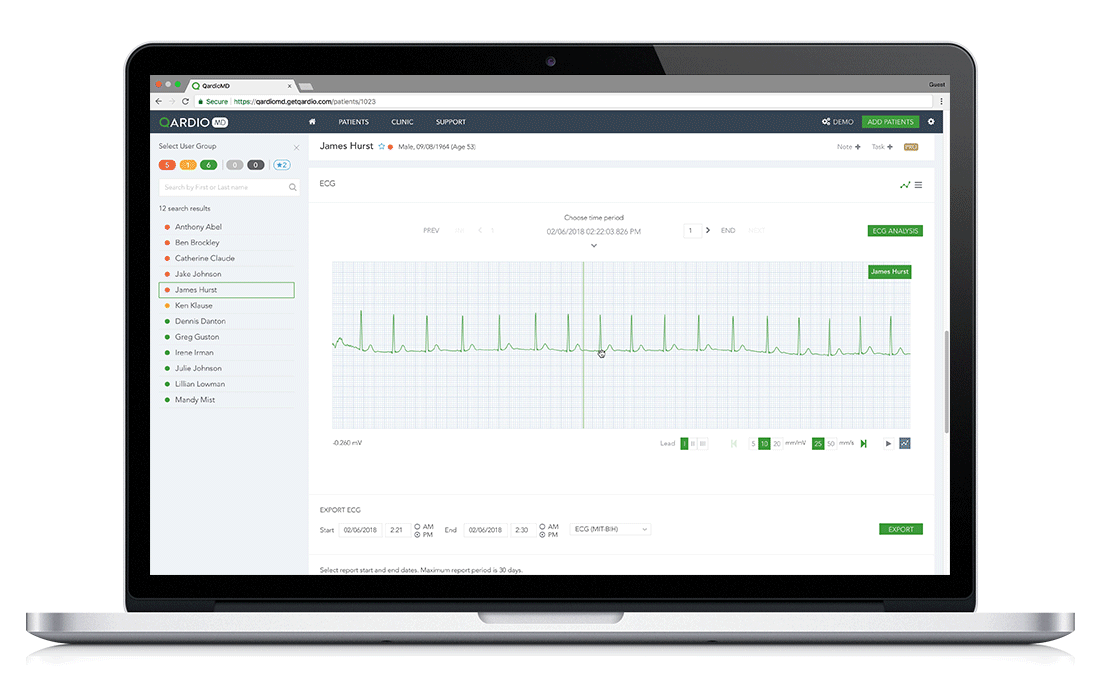 QardioCore – Kabelloser EKG-Monitor Mit Klinische Produktbild-Vorschau 2
