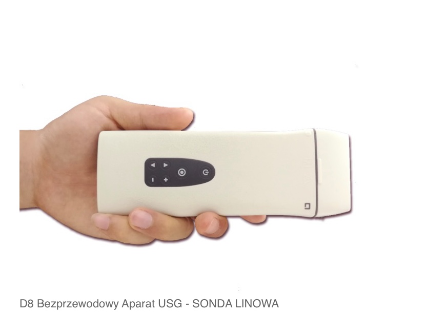 W ultrasonografii diagnostycznej liczy się nie tylko to, co widzimy na ekranie